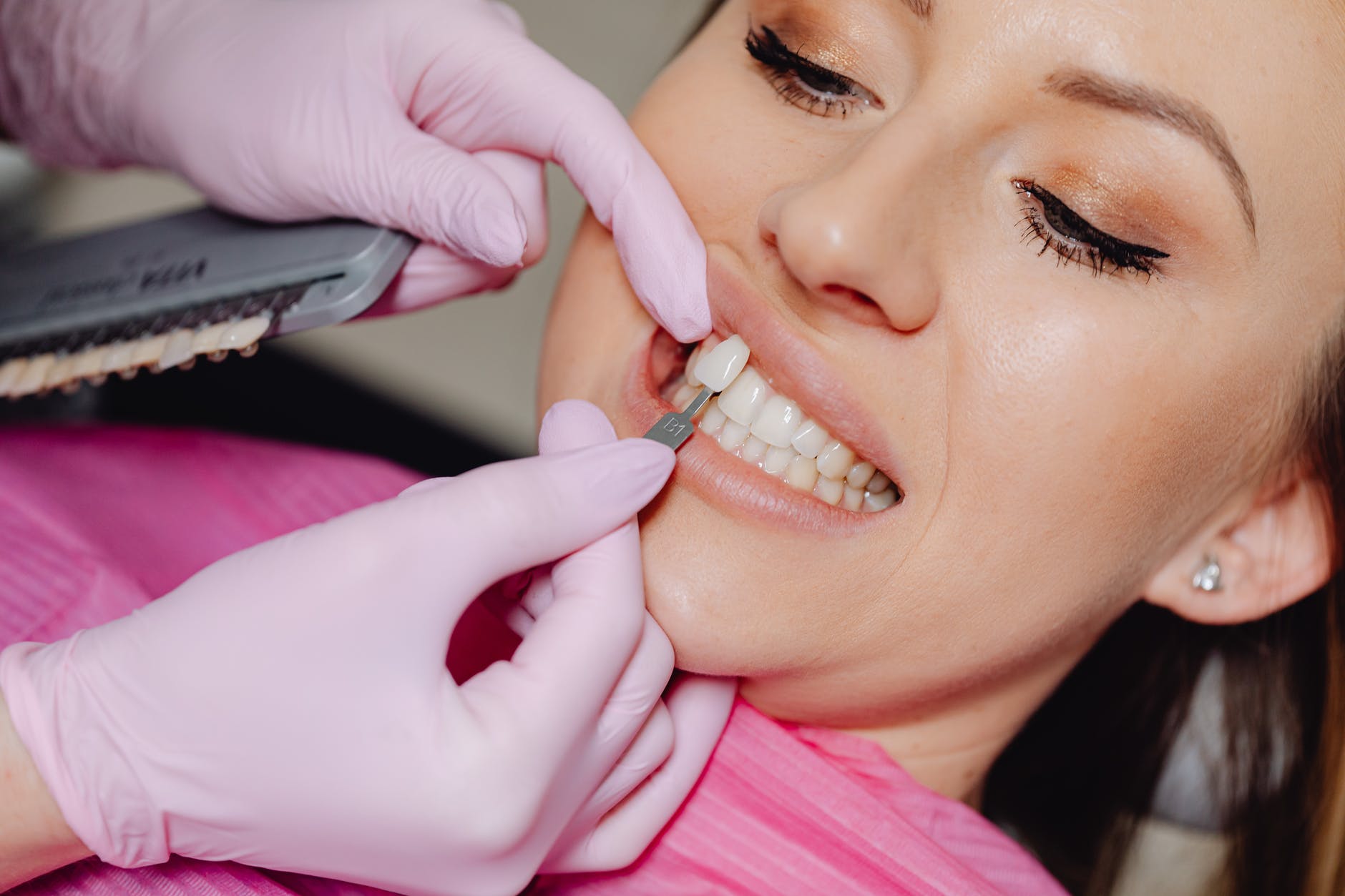 a dentist applying a veneer tooth on a patient
